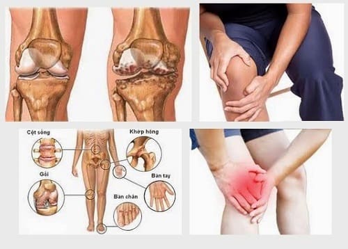 Công dụng của thủy xương bồ đối với sức khỏe