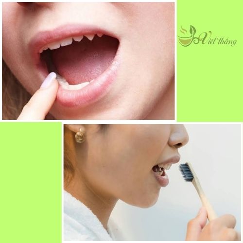 Nguyên nhân gây đắng miệng vào buổi sáng